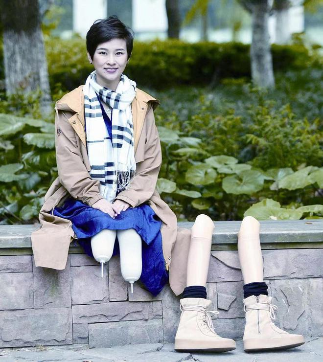 月大的女儿、丈夫出轨却活成自己的女王爱游戏平台她23岁失去双腿和10个