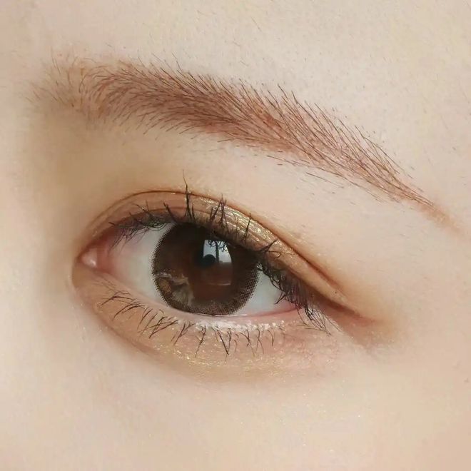 密眼周年轮重获青春双眼不是梦爱游戏(ayx)杭州美莱：解(图3)